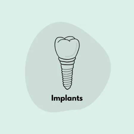 Dental Implants