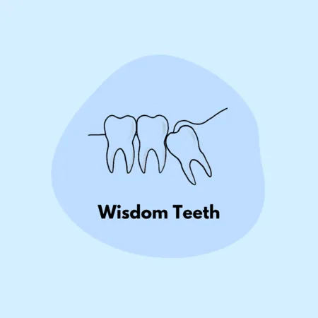 Wisdom Teeth